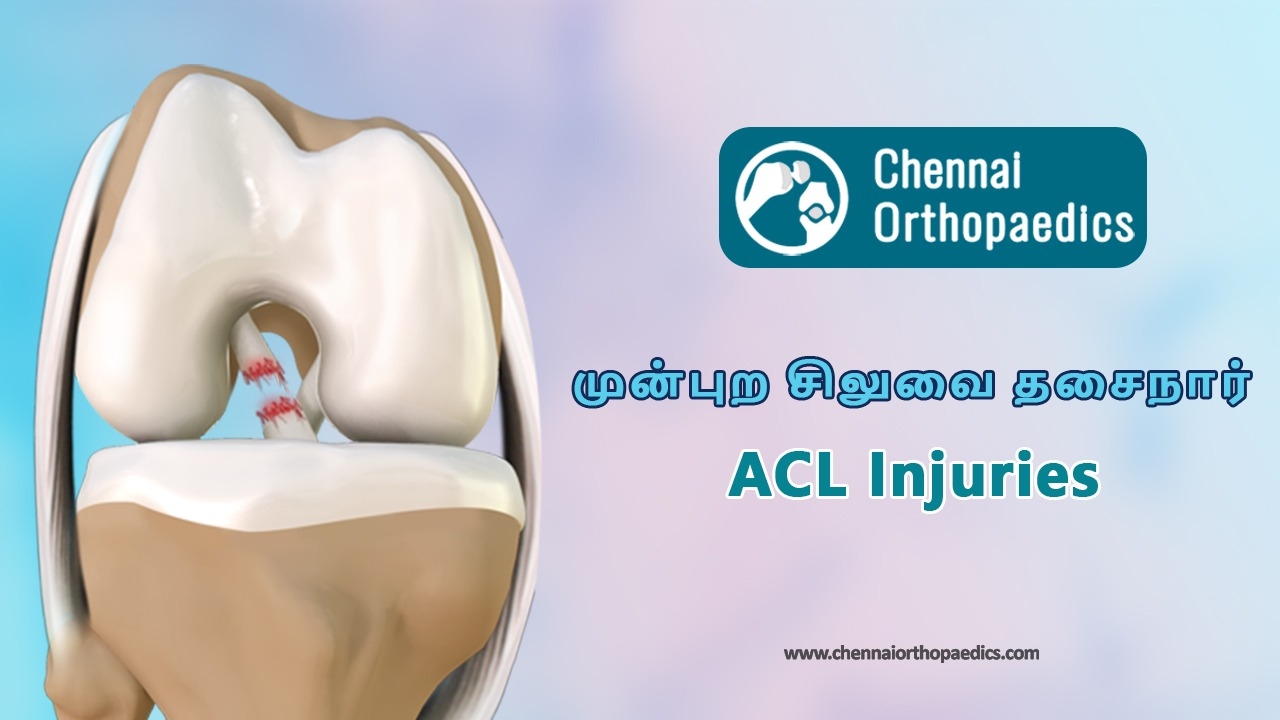 ACL Injury Treatment In Chennai  @ Dr Bharani  Kumar Dayanandam