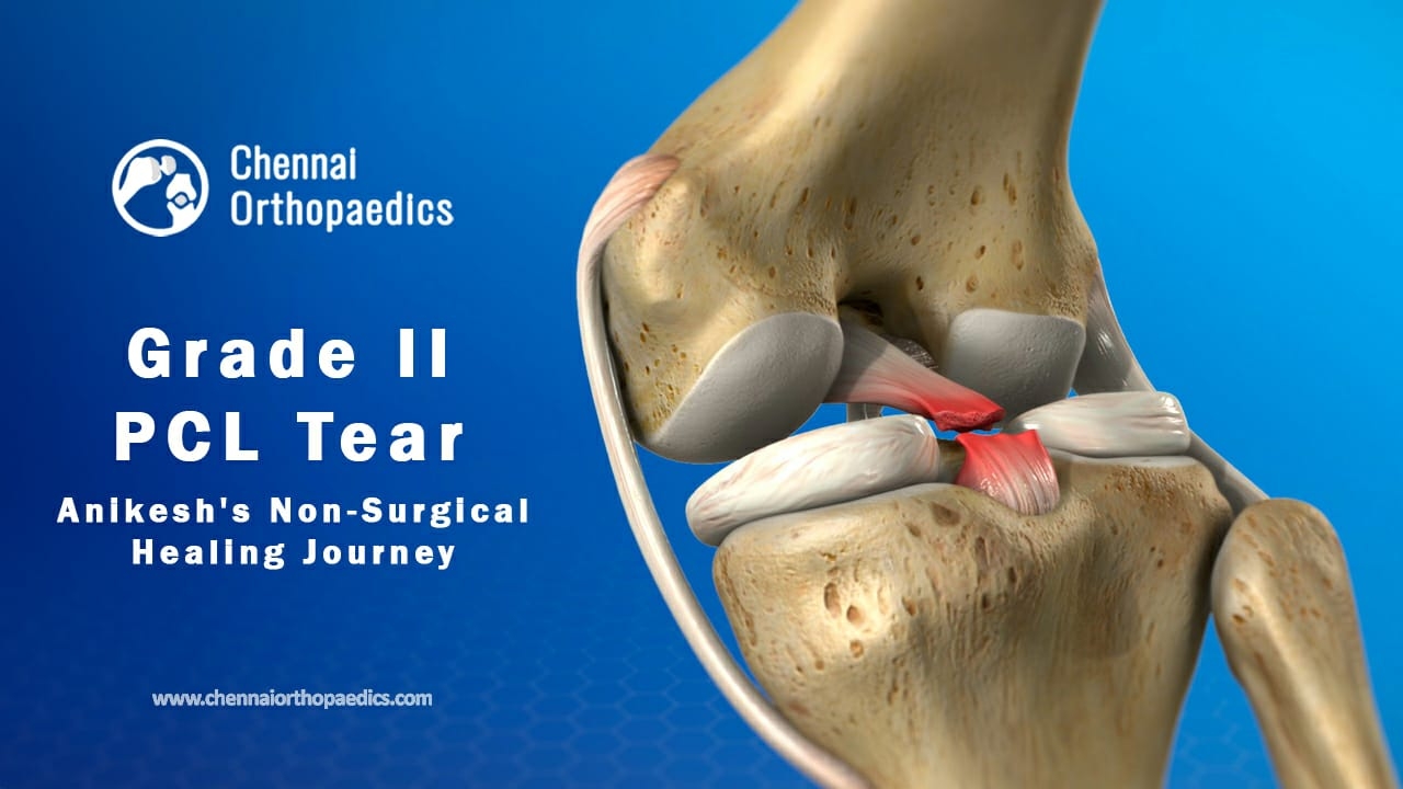 PCL Tear Non-Surgical Treatment @ Dr Bharani  Kumar Dayanandam