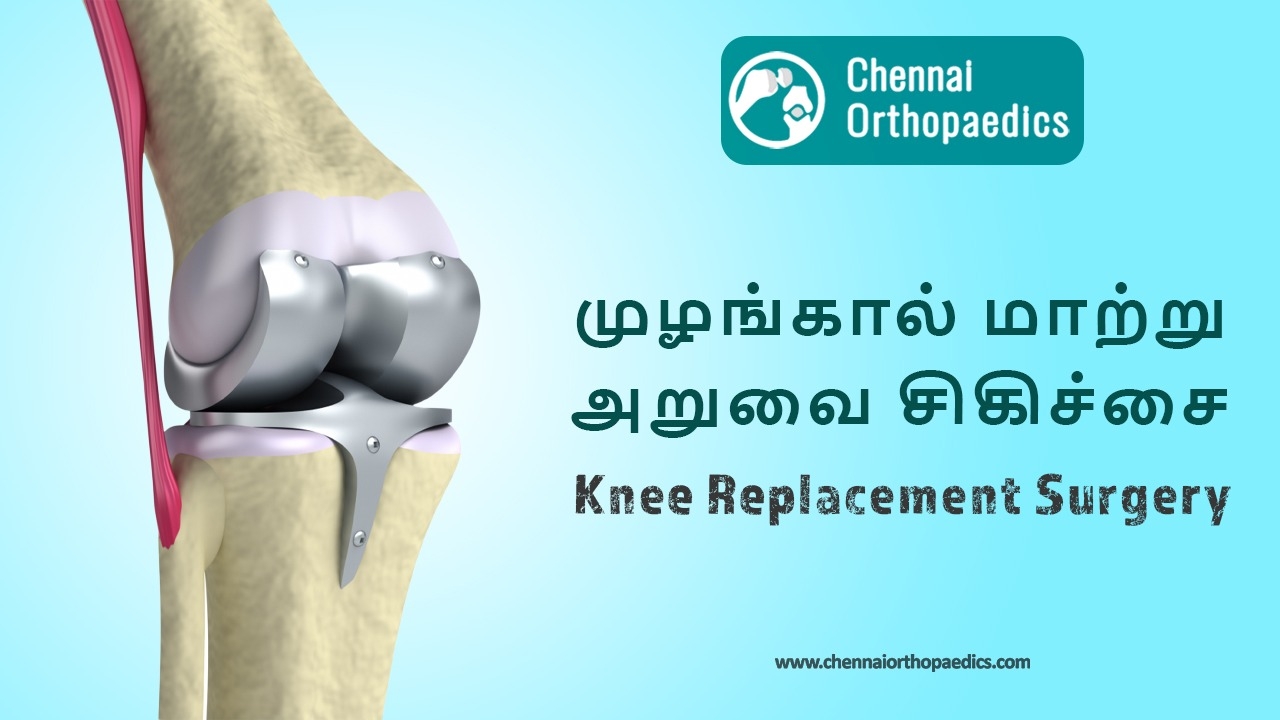 total-knee-replacement-surgery