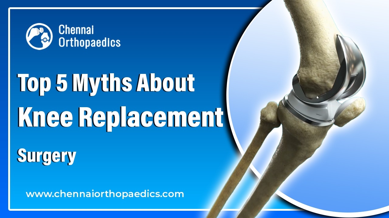 top-5-myths-about-knee-replacement-surgery