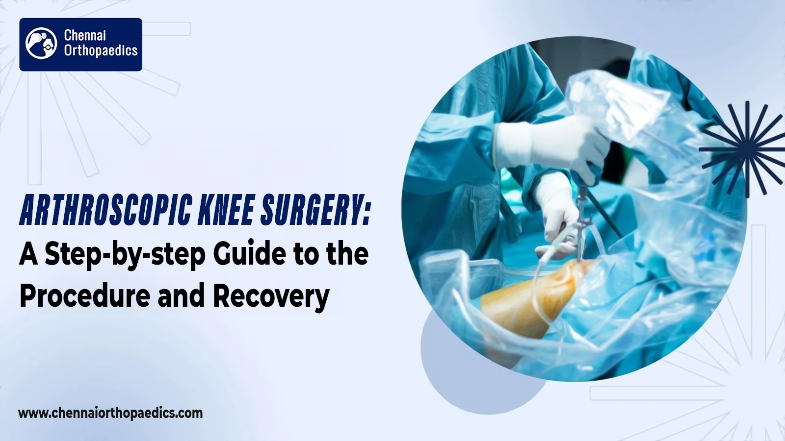 arthroscopic-knee-surgery