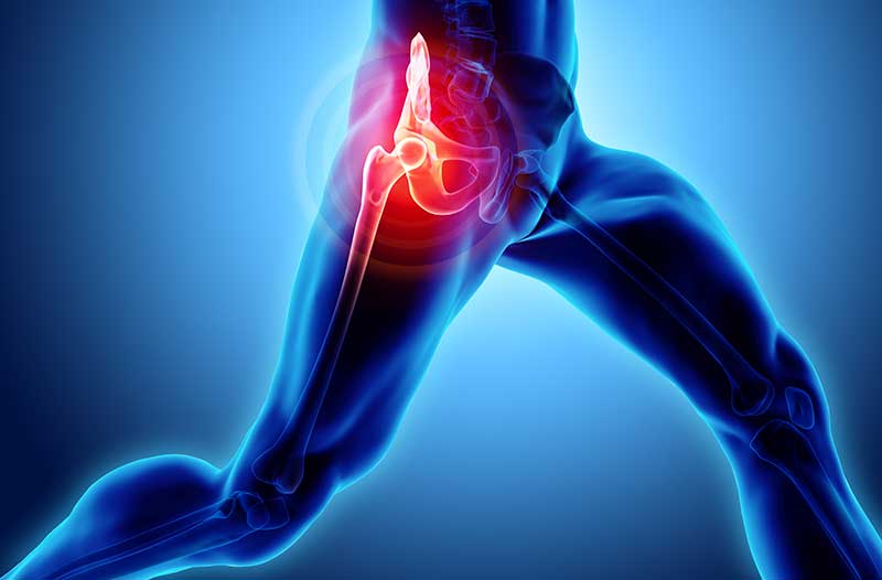 Hip Pain from Overuse or Prolonged Inactivity