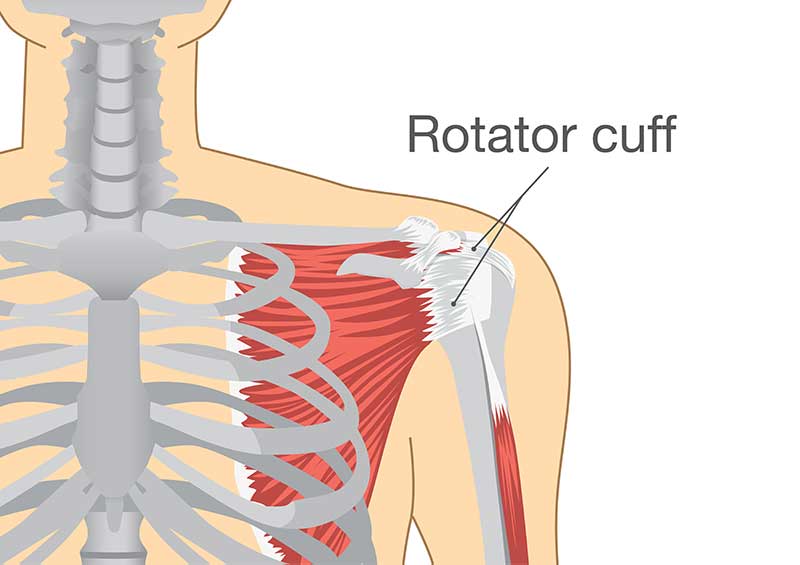 Arthroscopic Rotator Cuff Repair Surgery in chennai