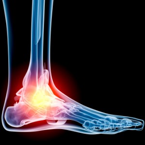 ankle - chennaiortho Ankle Joint Pain Treatment for Overuse and Inactivity