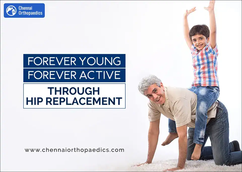 When Should You Opt For Hip Replacement?