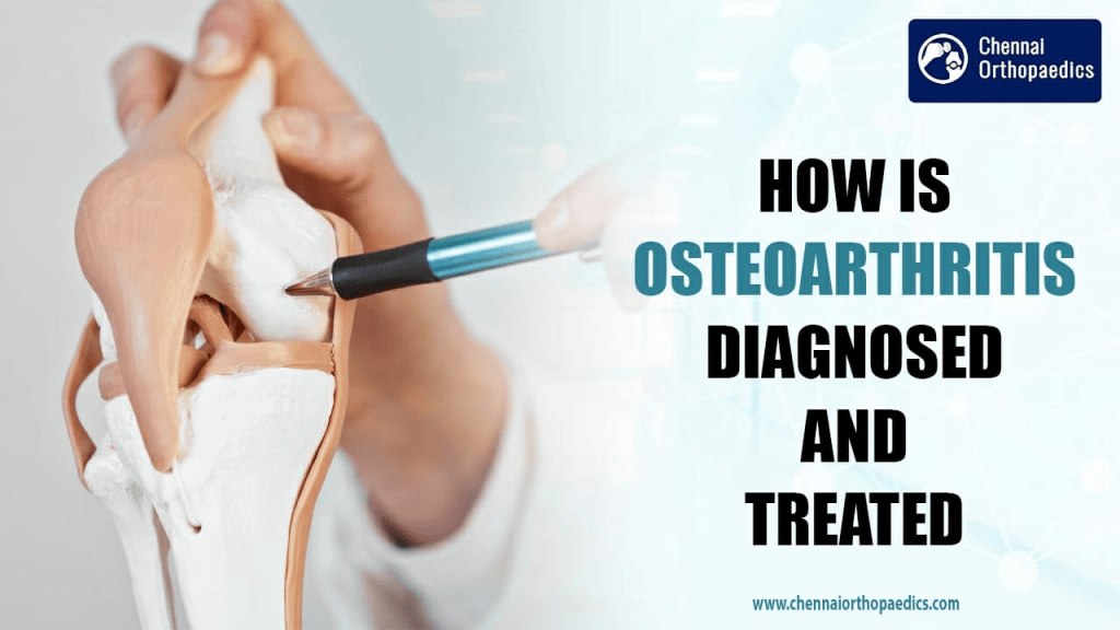 How is Osteoarthritis Diagnosed and Treated