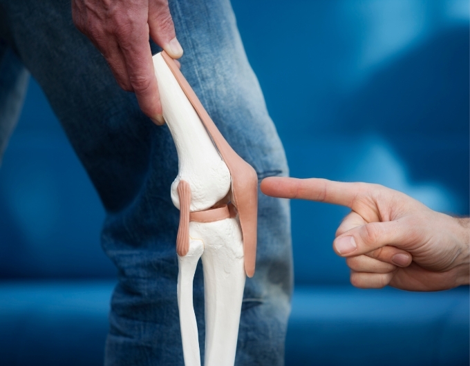 Knee joint model showing arthritis area.