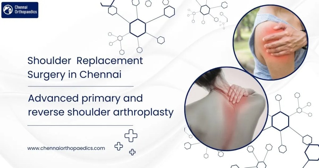 Shoulder Replacement Surgery In Chennai at Chennai Orthopaedics - chennaiortho Shoulder Replacement Surgery In Chennai at Chennai Orthopaedics